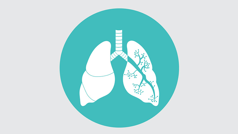 Nova pesquisa sobre câncer de pulmão mostra que brasileiros não discutem a doença com o médico