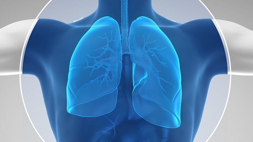 Carboidratos podem aumentar o risco de câncer de pulmão