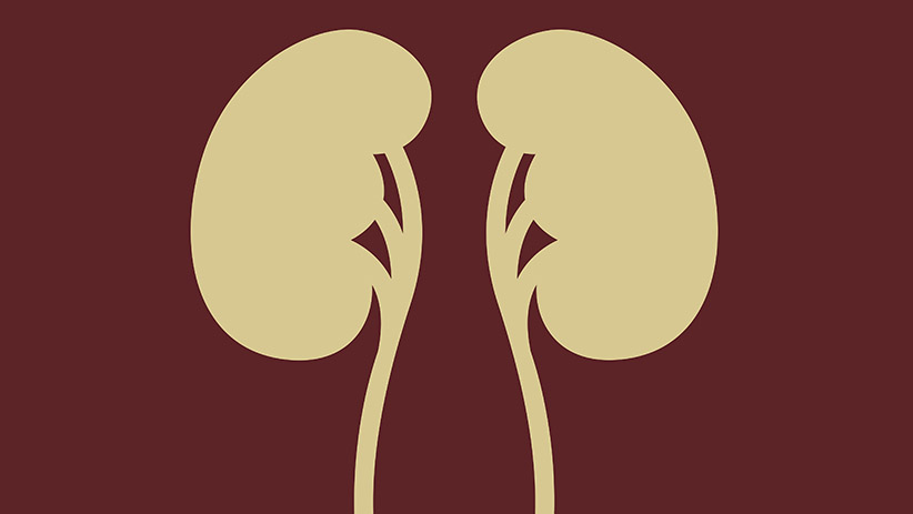 Risco de recidiva de tumor renal