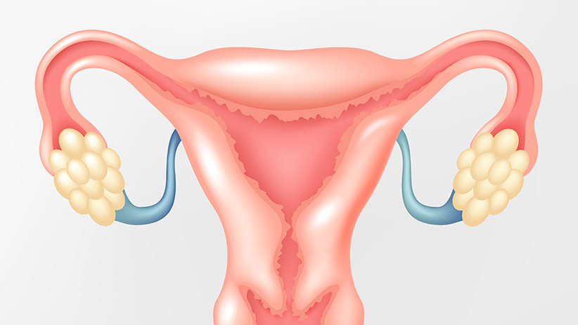 Em caso de carcinoma in situ, melhor retirar o útero?