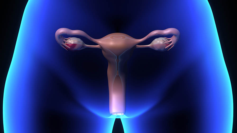 Exames para detectar câncer de colo do útero