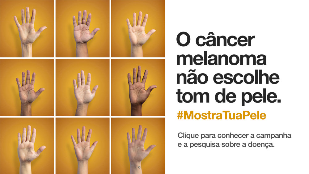 Participe da campanha #MostraTuaPele e previna-se contra o câncer melanoma
