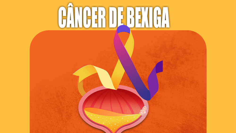 Cartilha Instituto Vencer o Câncer – Câncer de Bexiga
