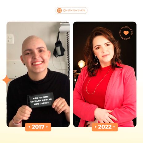 Imagem mostra: Lado direito foto de 2017 quando Duda esta em tratamento do câncer; lado esquerdo ela atualmente em 2022 curada.