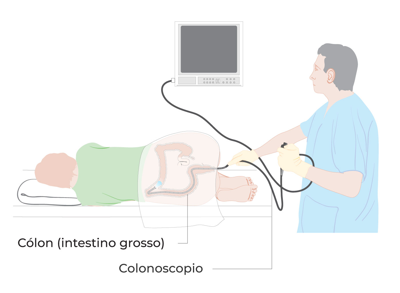 Diagrama que mostra a realização de uma colonoscopia