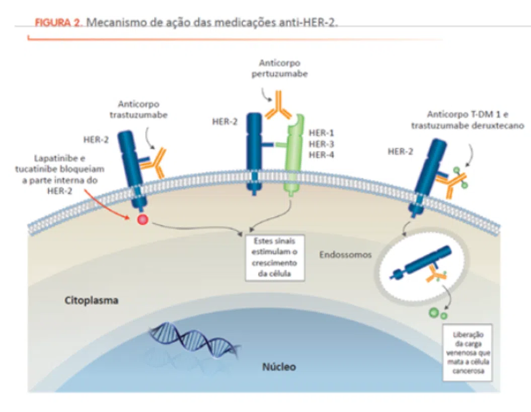 Tratamento do câncer de mama