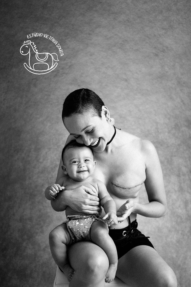 Lyana com sua filha apoiada na perna com cicatriz da mastectomia à mostra.