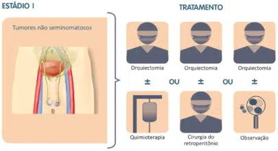 Tratamento do câncer de testículo