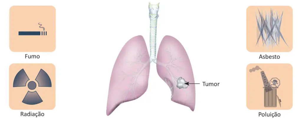 Fatores de risco do câncer de pulmão
