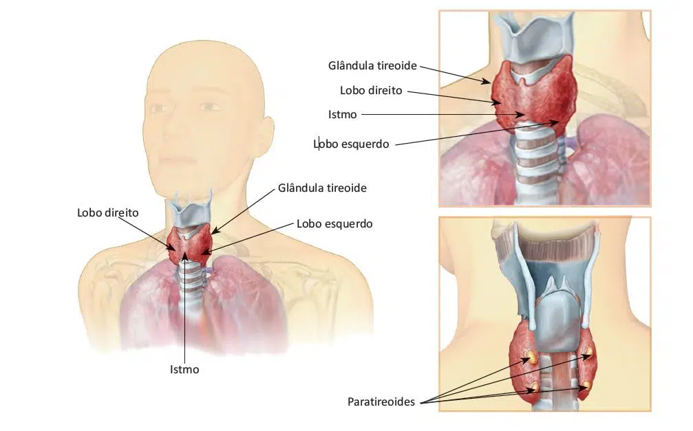 O que é câncer de tireoide?