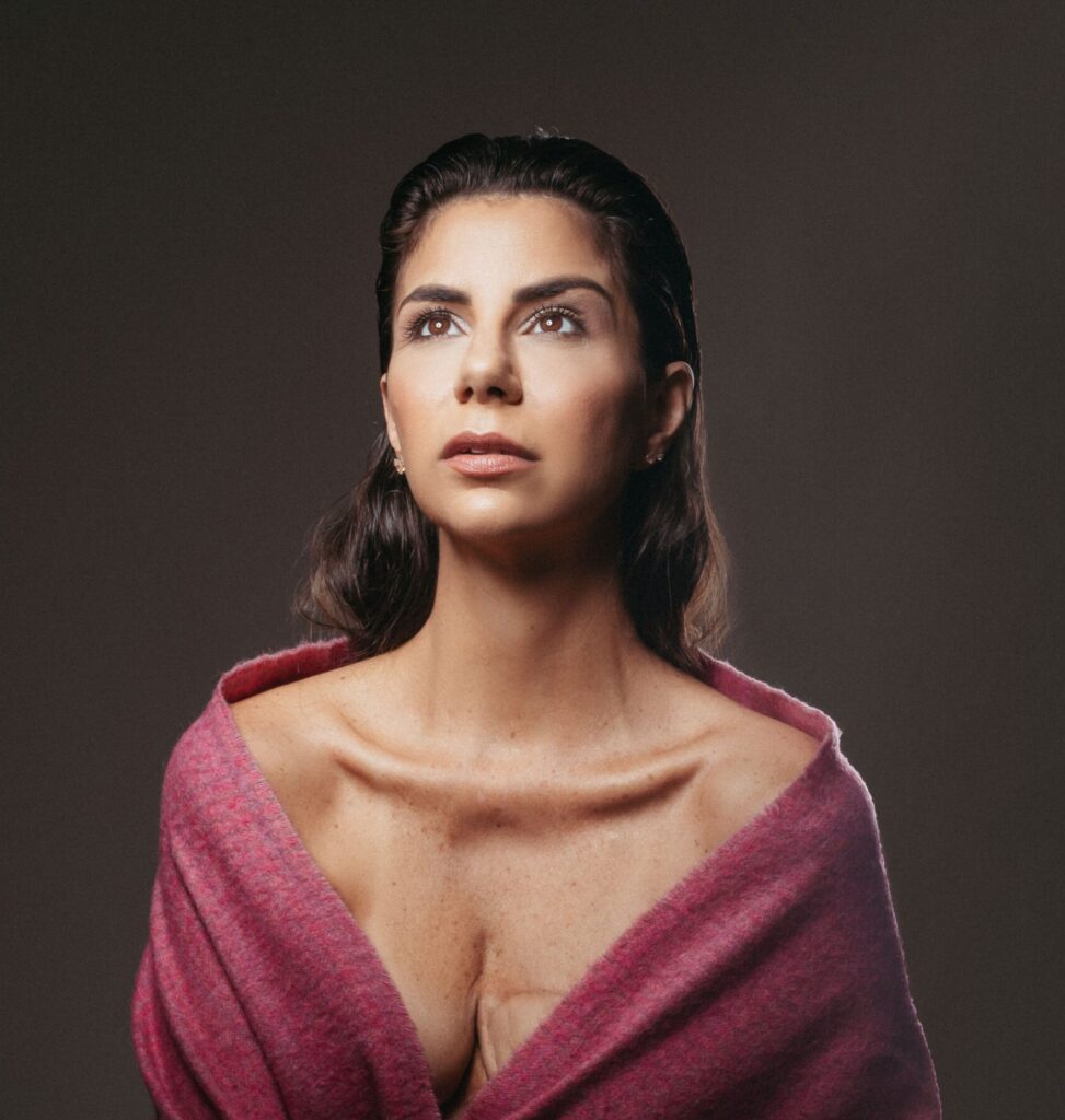 Relatos da Jornada - “Sua cicatriz não é comercial, ela não vende nosso produto.”