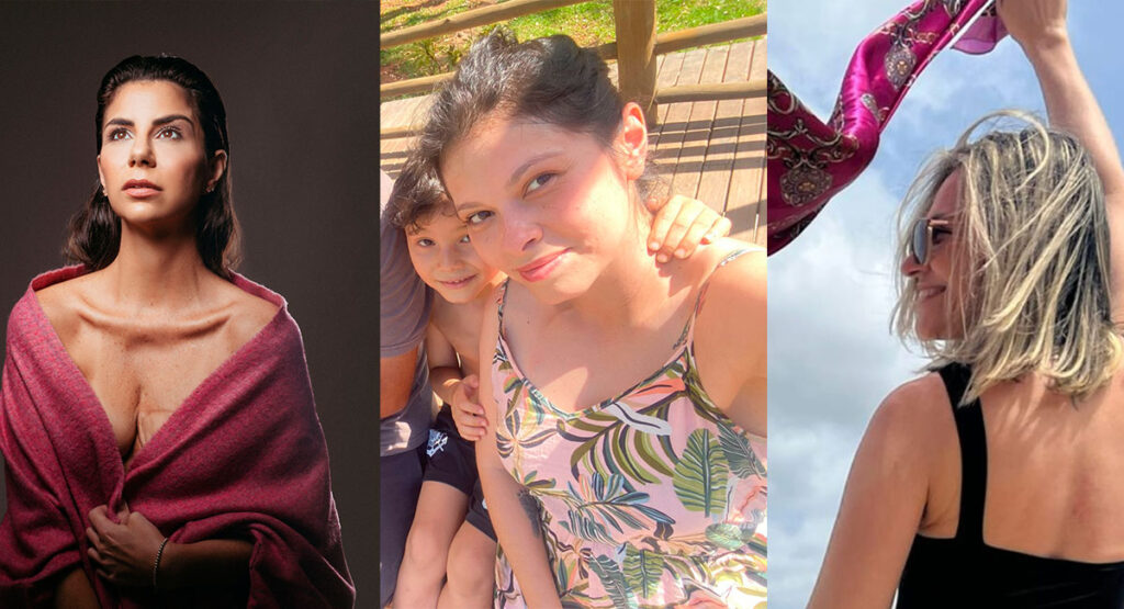 Especial Relatos da Jornada - Não é só uma mama, não é só um cabelo, não é só uma paciente. É uma mulher!